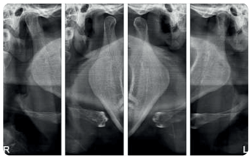 SAEVO SXR 2D PAN Image 1a