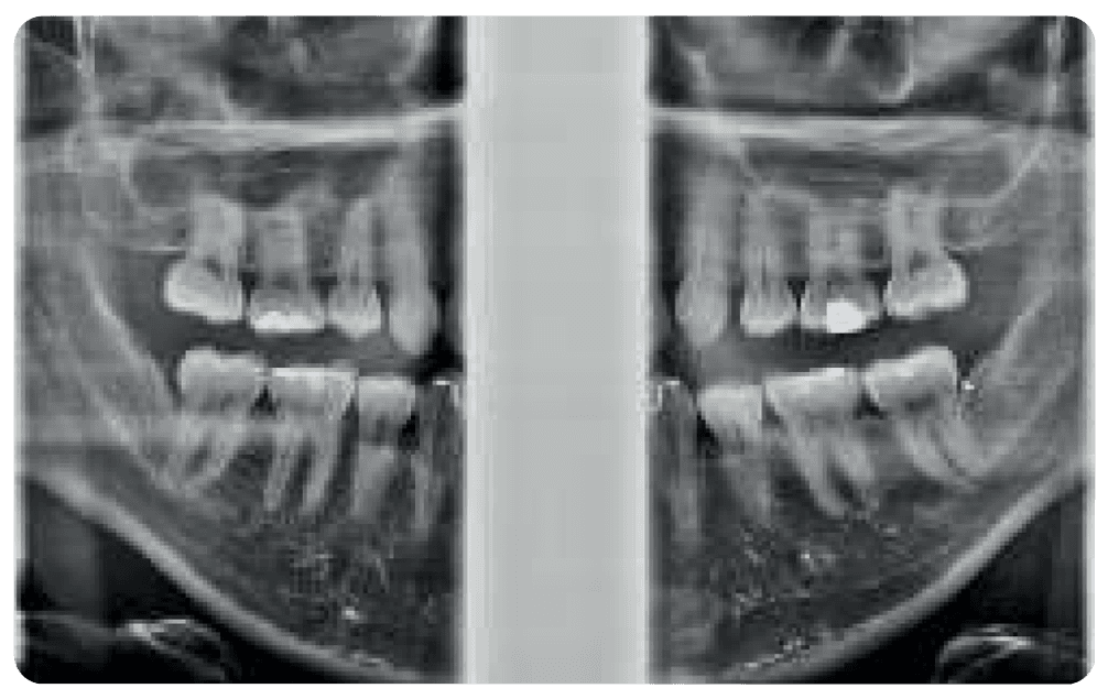 SAEVO SXR 2D PAN Image 1c