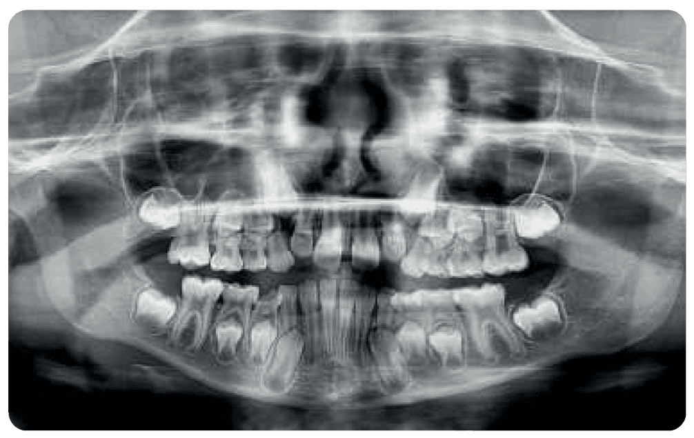 SAEVO SXR 2D PAN Image 1d