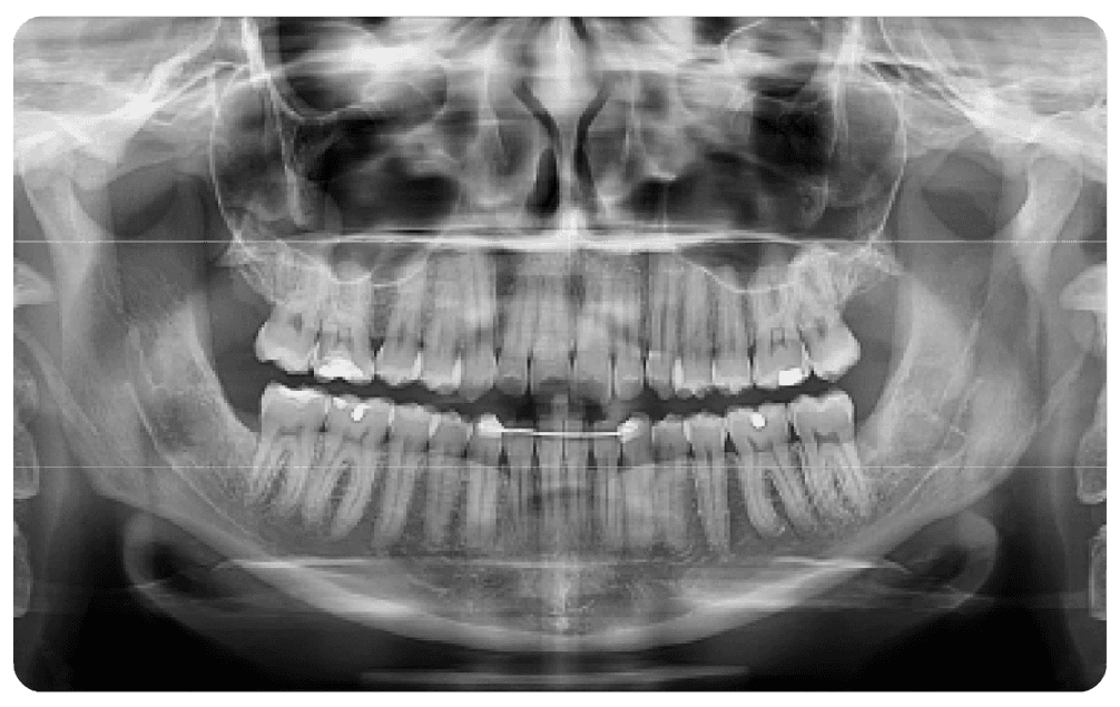 SAEVO SXR 2D PAN Image 1e