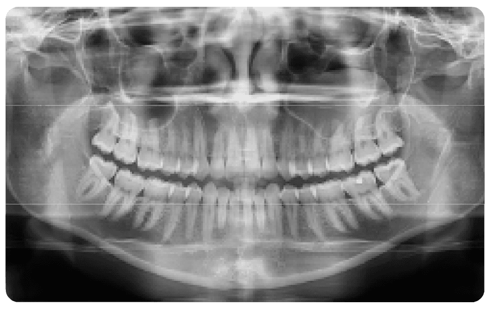 SAEVO SXR 2D PAN Image 1f