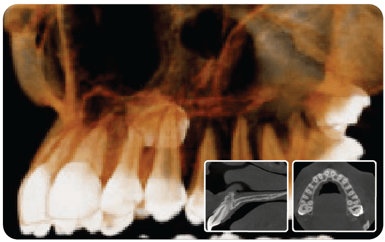 SAEVO SXR 3D CBCT Image 3dC