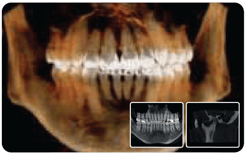 SAEVO SXR 3D CBCT Image 3da