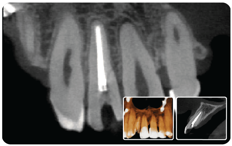 SAEVO SXR 3D CBCT Image 3dd