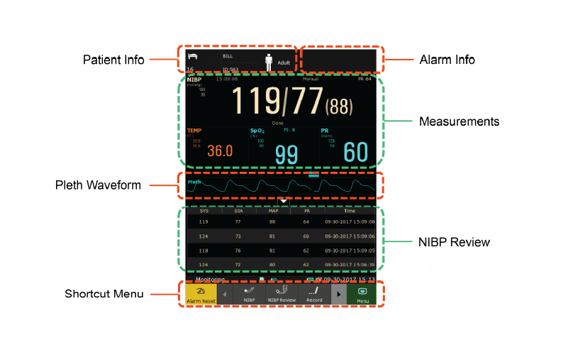EDAN iM3 Vital Signs Monitor Detail D