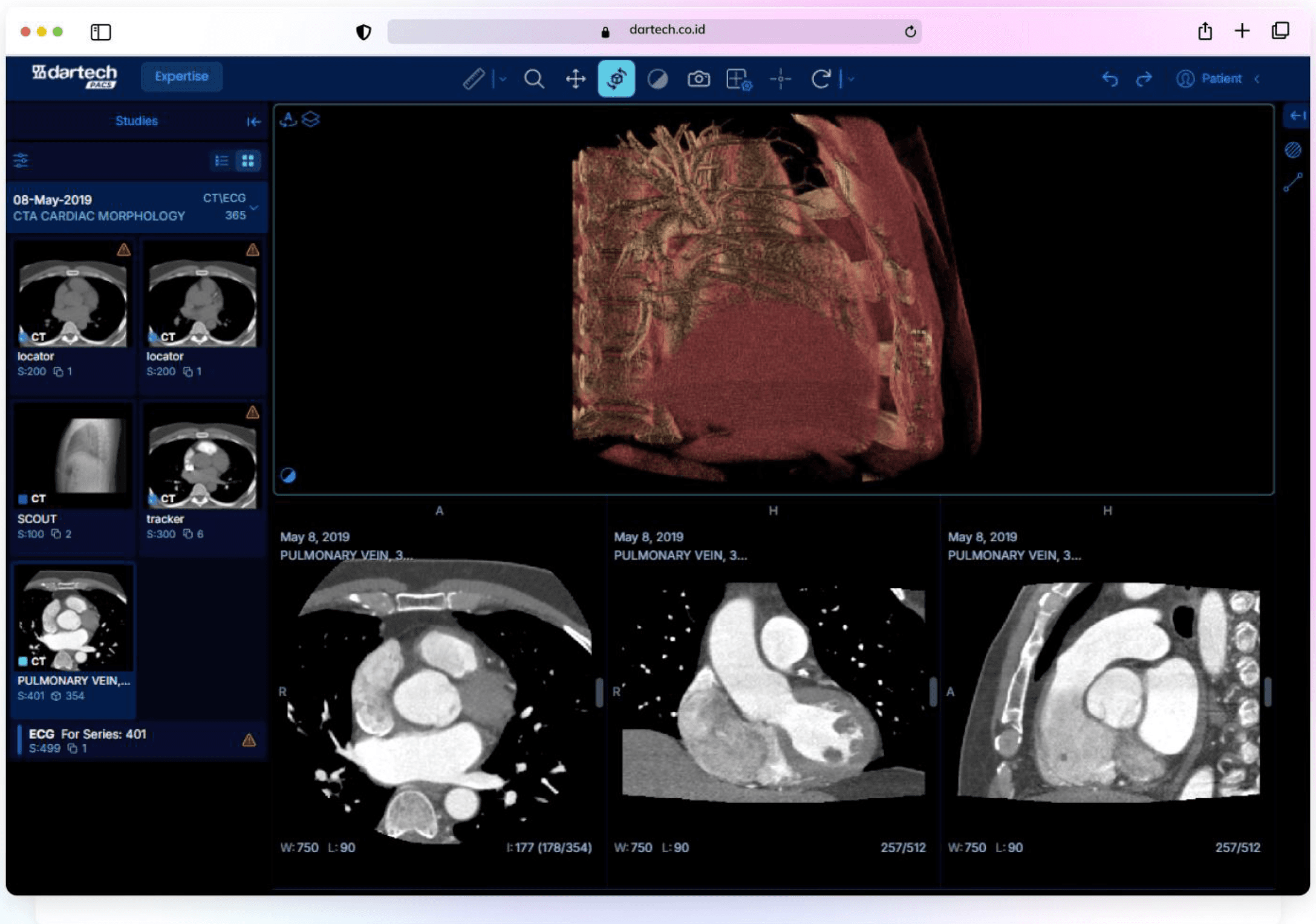 Dartech PACS CT 2