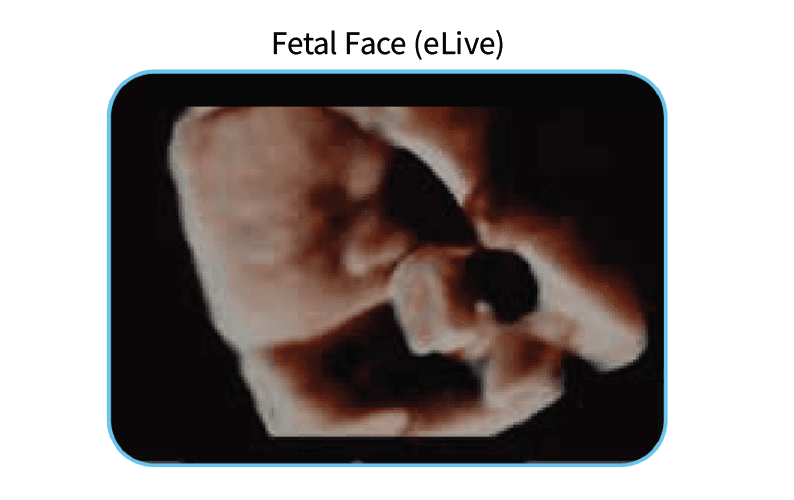 EDAN Acclarix AX3 Diagnostic Ultrasound System Image C