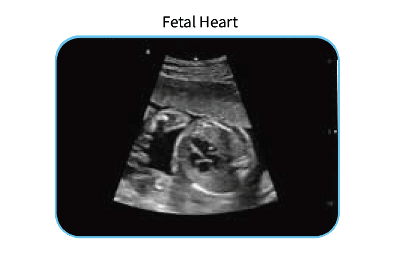 EDAN Acclarix AX3 Diagnostic Ultrasound System Image D