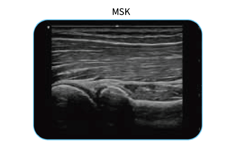 EDAN Acclarix AX3 Diagnostic Ultrasound System Image E