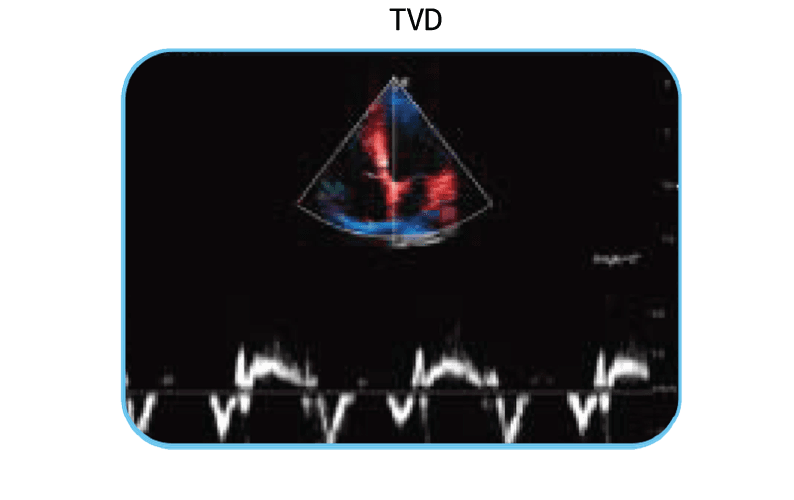 EDAN Acclarix AX3 Diagnostic Ultrasound System Image F