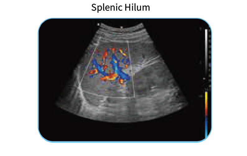 EDAN Acclarix AX3 Diagnostic Ultrasound System Image G