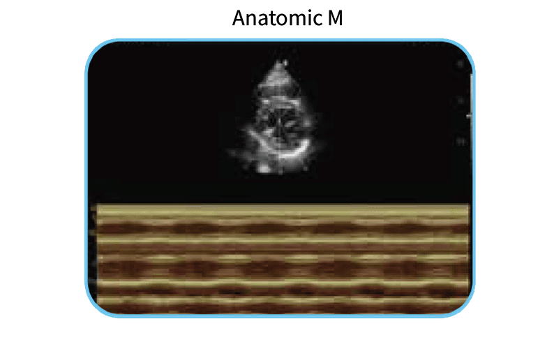 EDAN Acclarix AX3 Diagnostic Ultrasound System Image H