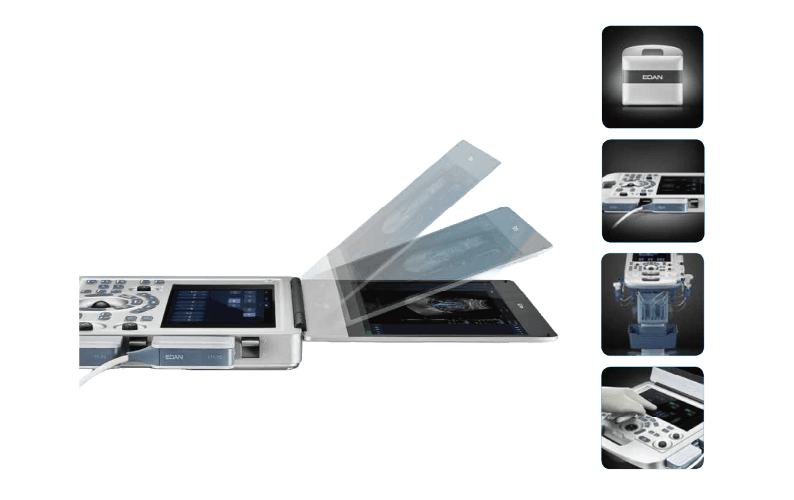 EDAN Acclarix AX3 Diagnostic Ultrasound System Image I